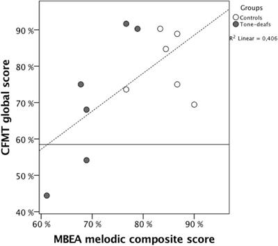 Developmental Perceptual Impairments: Cases When Tone-Deafness and Prosopagnosia Co-occur